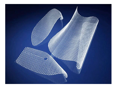 example of transvaginal mesh