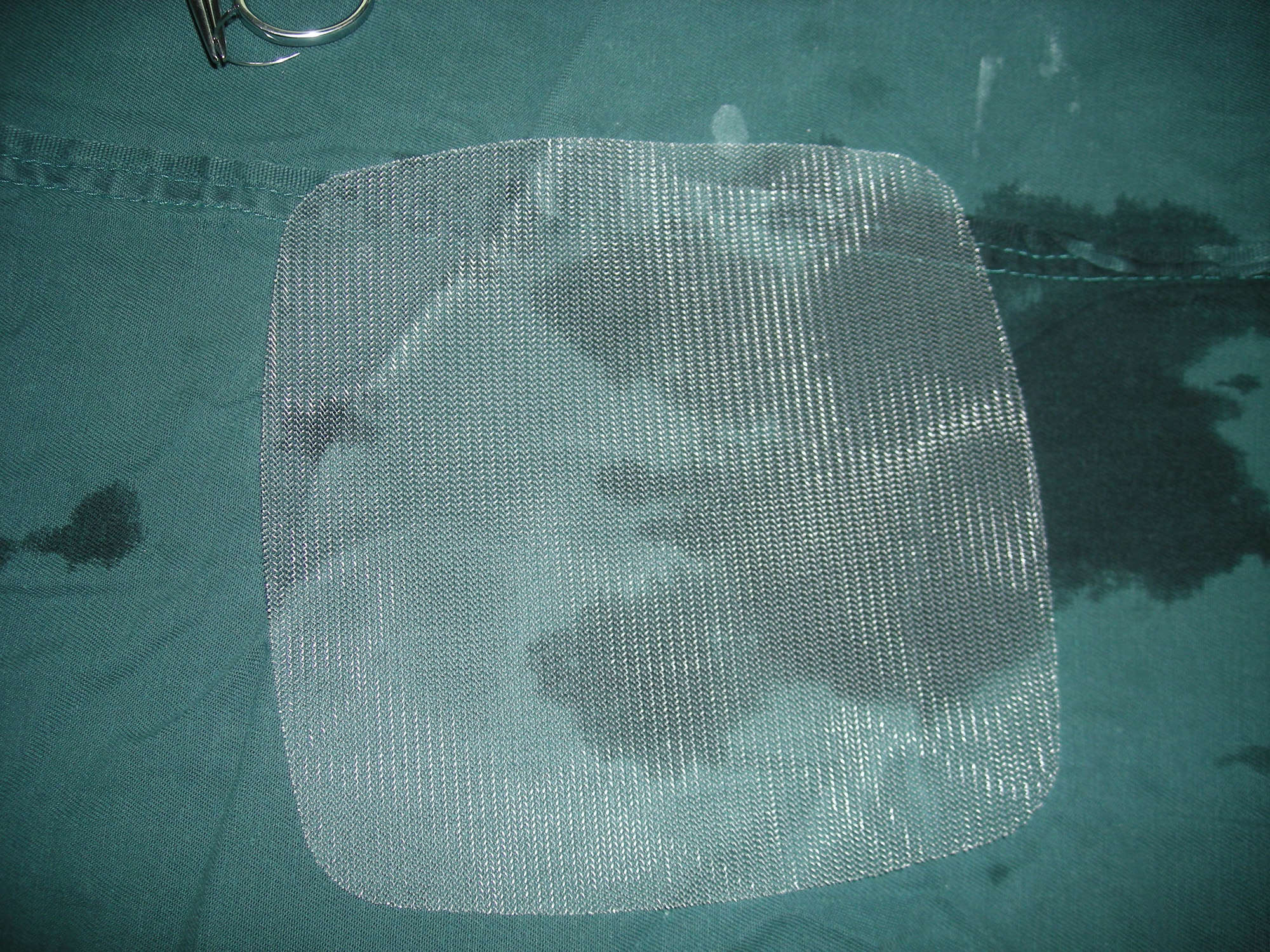 Surgical Mesh