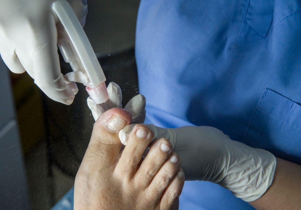 Cartiva Implant Recall.