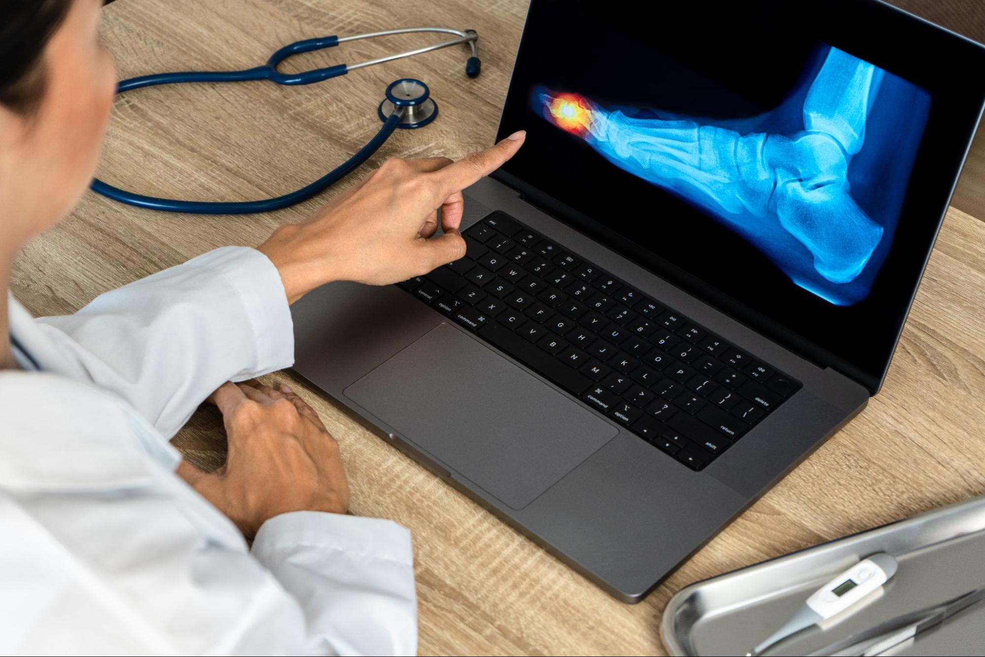 Close up of doctor showing a x-ray of foot.